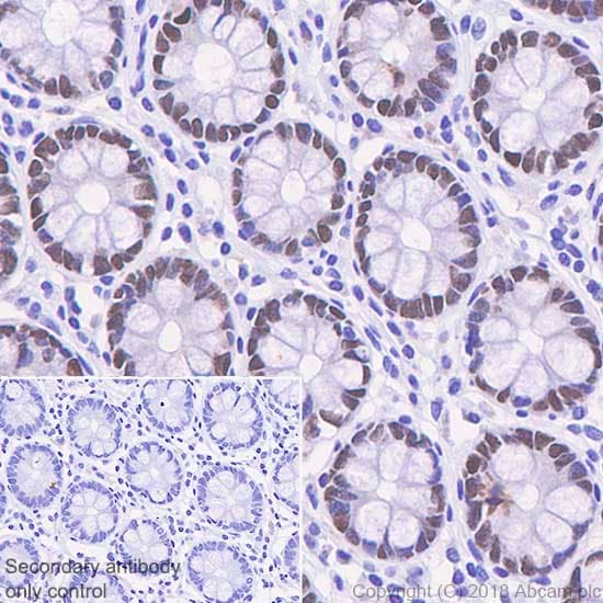 Anti-SATB2 antibody [SP281] - C-terminal(AB227686)