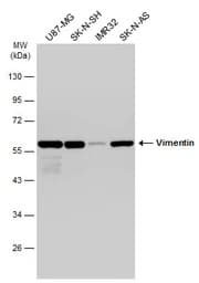 Anti-Vimentin antibody(AB137321)