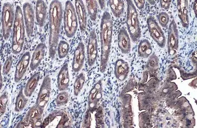 Anti-Villin antibody(AB97512)