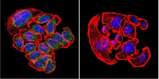 Kdel Antibody Ab2898  Immunocytochemistry Immunofluorescence Img103063