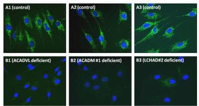 Fatty Acid Oxidation Assay Kit (flow cytometry)(AB118183)