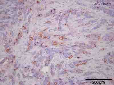 Muc1 Antibody Sm3 Ab22711  Immunohistochemistry Formalin Pfa Fixed Paraffin Embedded Sections Img138110