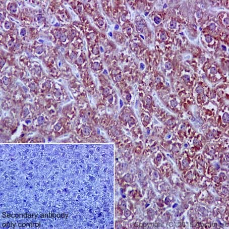Anti-SOD2/MnSOD (acetyl K68) antibody [EPVANR2](AB137037)
