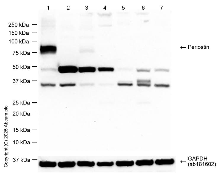 Periostin Antibody Epr19936 Ab219057  Western Blot Img452330