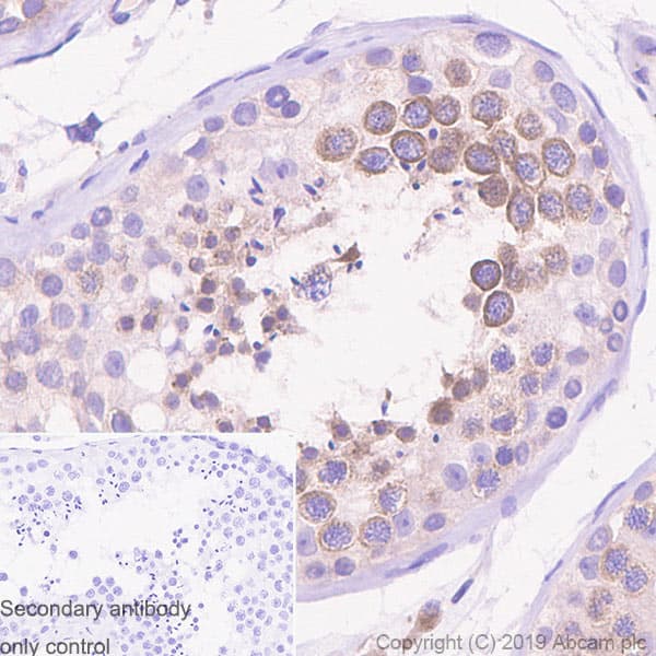 Ythdc2 Antibody Epr21820 49 Bsa And Azide Free Ab259277  Immunohistochemistry Formalin Pfa Fixed Paraffin Embedded Sections Img122194