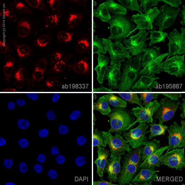 Alexa Fluor® 647 Anti-RAB7 antibody [EPR7589](AB198337)