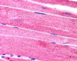 Sorbs1 Antibody Ab4551  Immunohistochemistry Formalin Pfa Fixed Paraffin Embedded Sections Img112027