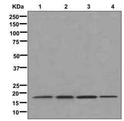 Anti-Ribosomal protein S11/RPS11 antibody [EPR11487](AB175213)