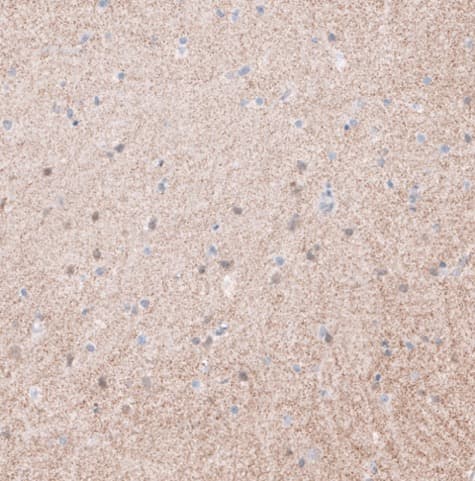 Anti-Synaptopodin antibody(AB224491)