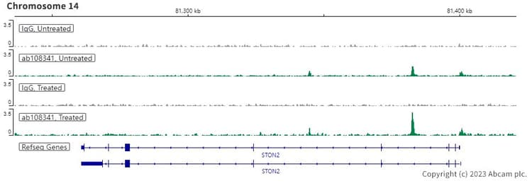 Anti-Androgen Receptor antibody [ER179(2)] - ChIP Grade(AB108341)
