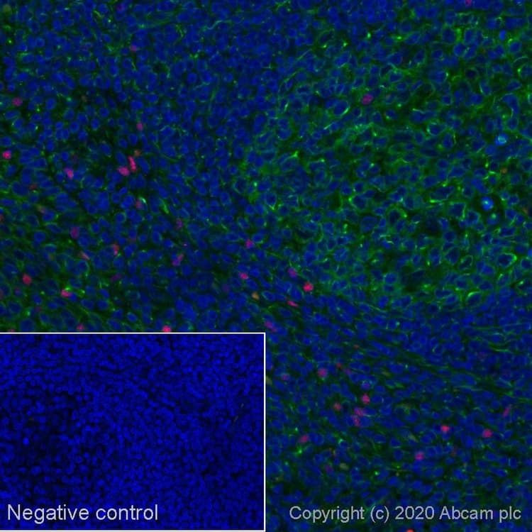 Alexa Fluor® 647 Anti-FOXP3 antibody [SP97](AB275079)