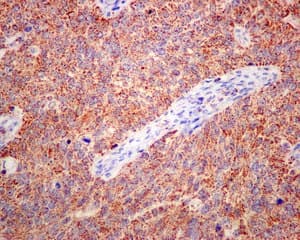 Ethe1 Antibody Epr11697 Bsa And Azide Free Ab249805  Immunohistochemistry Formalin Pfa Fixed Paraffin Embedded Sections Img132711