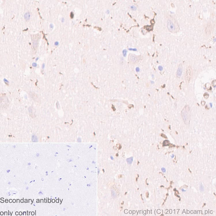 Iba1 Antibody Epr61362 Microglia Marker Ab178680  Immunohistochemistry Formalin Pfa Fixed Paraffin Embedded Sections Img176401