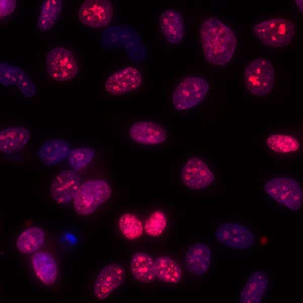 Ki67 Antibody Blr021e Ab243878  Immunocytochemistry Immunofluorescence Img173601