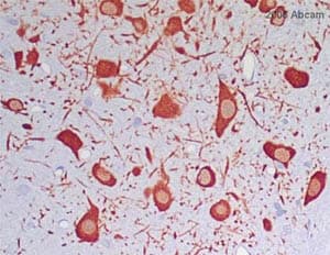 Anti-Tyrosine Hydroxylase antibody - Neuronal Marker(AB112)