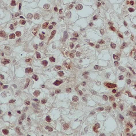 Anti-Alpha-synuclein antibody [MJFR1](AB138501)