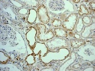 Anti-Niemann Pick C1 antibody [EPR5209] - BSA and Azide free(AB224268)