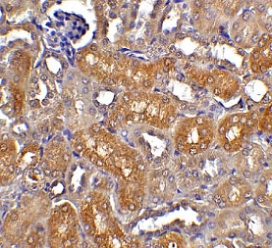 Anti-DFFB/CAD antibody(ab8401)