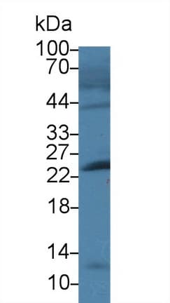 Anti-Cardiac Troponin I antibody(AB231064)
