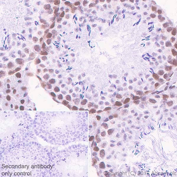 Anti-Cdk9 antibody [EPR3119Y](AB76320)