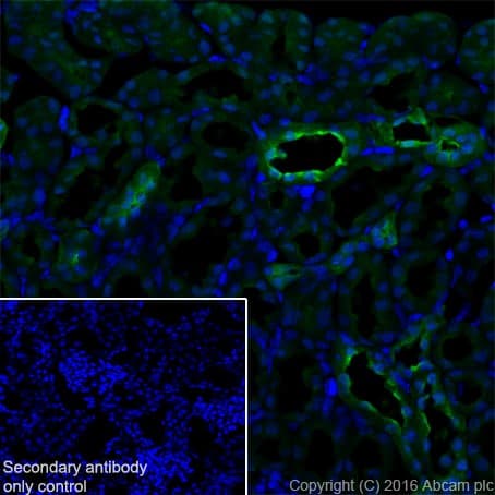 S100 Alpha Antibody Epr19013 Ab183979  Immunohistochemistry Frozen Sections Img112721