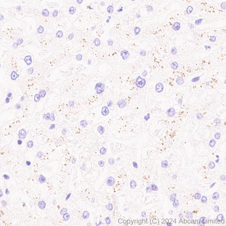 Anti-Tau antibody [EP2456Y](AB76128)
