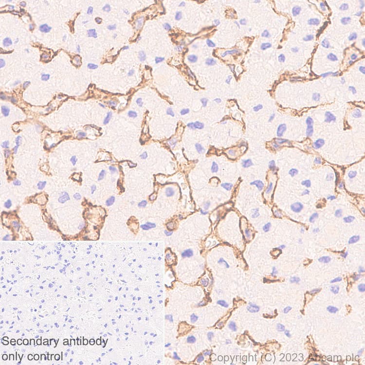 Anti-LYVE1 antibody [RM1067](AB314241)