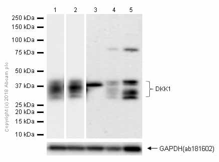 Dkk1 Antibody Epr4759 Ab109416  Western Blot Img60840
