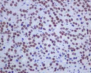 Anti-Androgen Receptor antibody [ER179(2)] - ChIP Grade(AB108341)