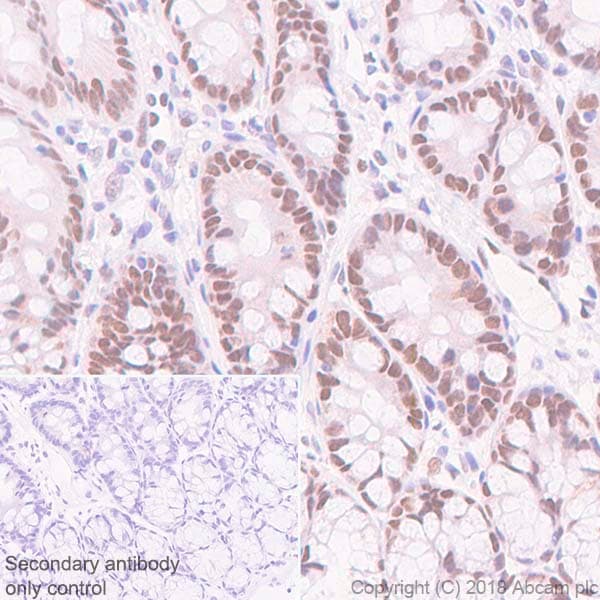 Anti-FOXP1 antibody [SP133] - C-terminal(AB227649)