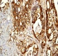 Eif4b Antibody Ep2299y Bsa And Azide Free Ab284714  Immunohistochemistry Formalin Pfa Fixed Paraffin Embedded Sections Img35358