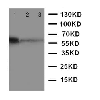 Mbd4 Med1 Antibody C Terminal Ab191037  Western Blot Img43239