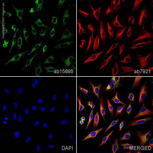 Anti-VDAC1/Porin + VDAC2 + VDAC3 antibody – Mitochondrial Loading Control(AB15895)