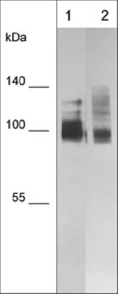 Cd44 Antibody M591 Ab253279  Western Blot Img133204