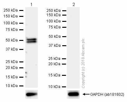 Cyp2c19 Antibody Epr6576 Ab137015  Western Blot Img60118