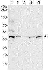 Ring2 Ring1b Rnf2 Antibody Ab101273  Western Blot Img111170