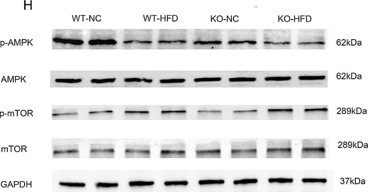 Anti-UCP1 antibody [EPR23004-34](AB234430)