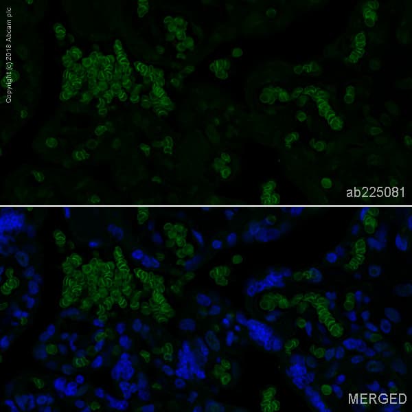 Alexa Fluor 488 Band 3 Ae 1 Antibody Epr1426 Ab225081  Immunohistochemistry Formalin Pfa Fixed Paraffin Embedded Sections Img83796