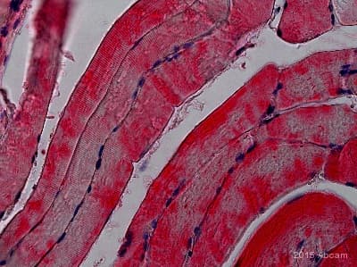 Anti-Glucose Transporter GLUT4 antibody(AB33780)