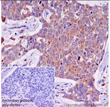 Anti-ATP6V0D1/P39 antibody [EPR18320-38](AB202899)