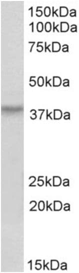 Hoxa10 Antibody Ab191470  Western Blot Img84102
