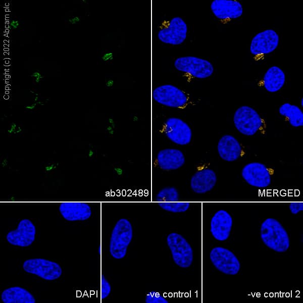 Anti-GM130 antibody [EP892Y] - Chicken IgY (Chimeric)(AB302489)