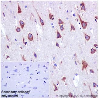 Anti-SSX2IP antibody [EPR16979] - BSA and Azide free(AB240348)