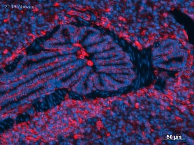 Anti-Vimentin antibody [RV202] - Cytoskeleton Marker(ab8978)