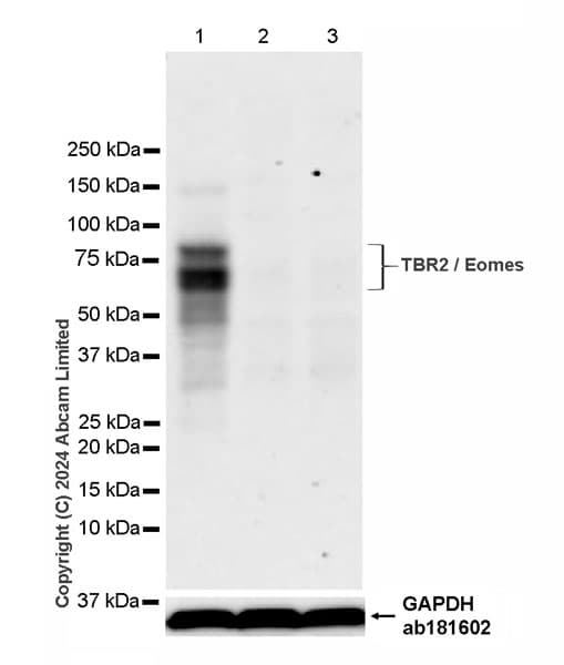 Anti-TBR2 / Eomes antibody [RM2055](AB319166)