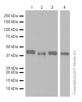 Anti-Glutamine Synthetase antibody [EPR13022(B)](AB176562)