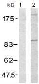 Anti-IGF1 Receptor antibody(AB131476)