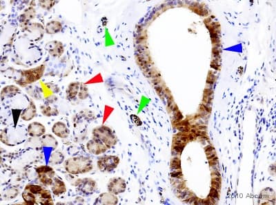 Anti-Tau (phospho S396) antibody [E178](ab32057)