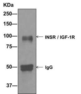 Anti-IGF1 Receptor + Insulin Receptor antibody [EPR2334(2)](AB172965)