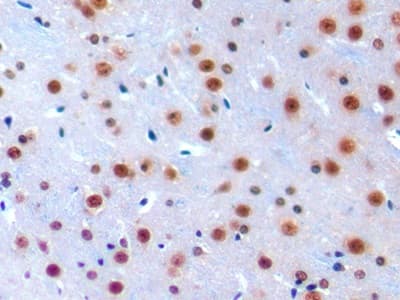 Anti-IRF1 antibody(AB232861)